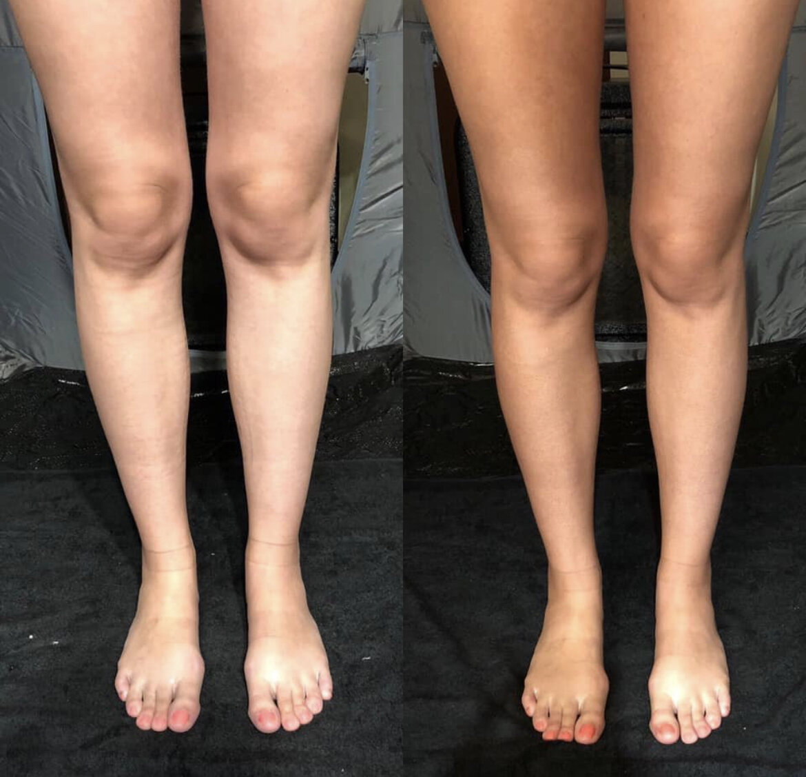 Legs showing Norvell spray tan in Panama City Beach, FL